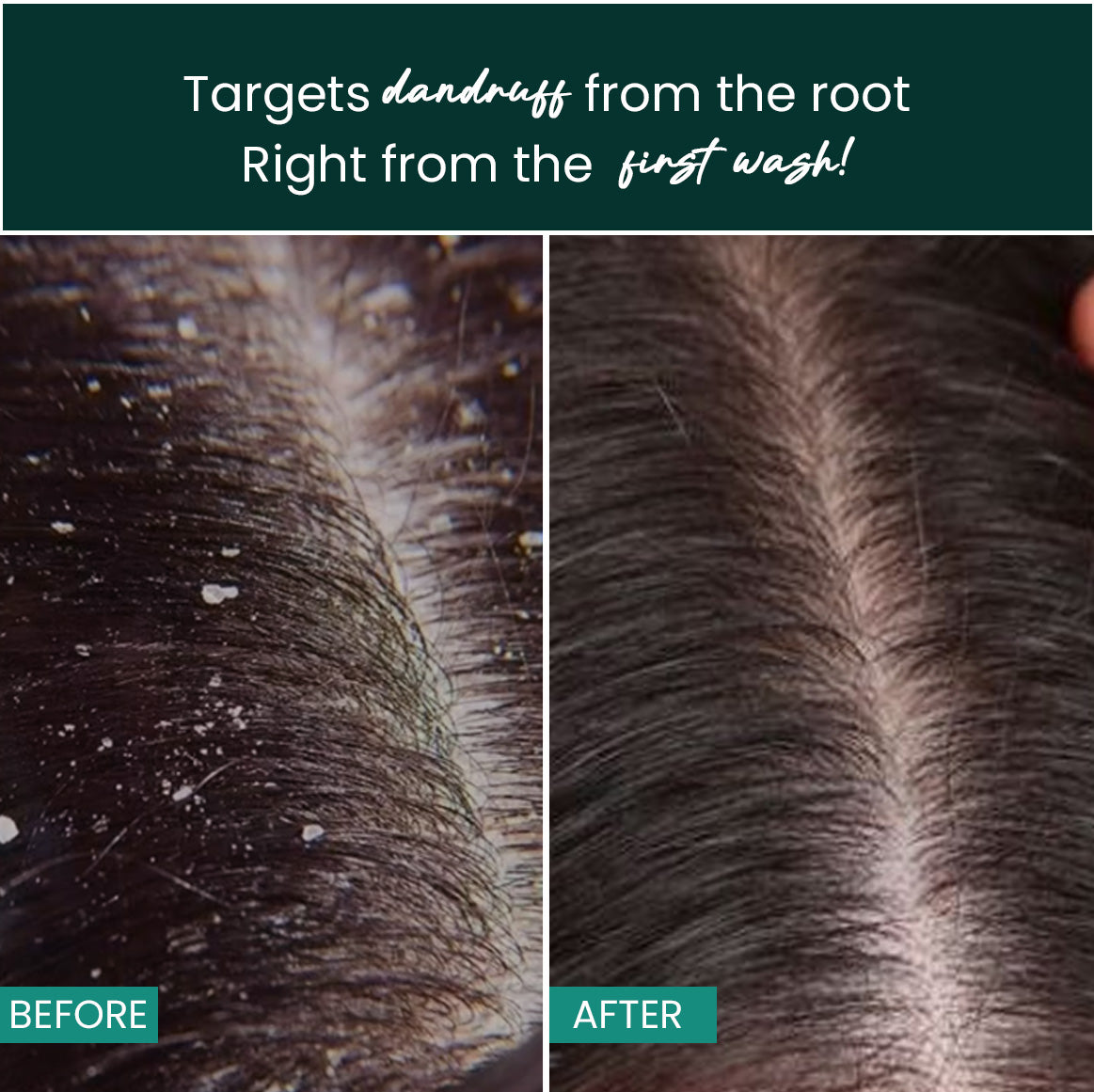 Tea Tree Neem Anti Dandruff Shampoo